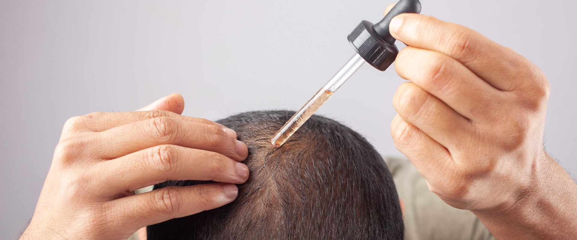 Understanding the Benefits and Uses of Minoxidil