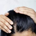 Understanding Menopause and Hair Loss: What You Need to Know