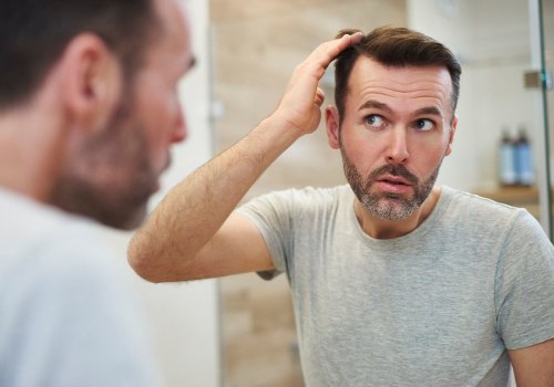 Understanding Hair Transplants: All You Need to Know