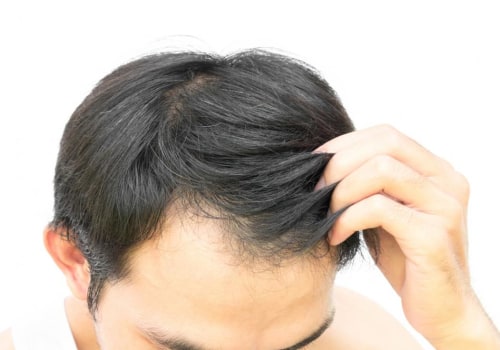 The Power of Hair Thickening Sprays: A Comprehensive Guide for Hair Restoration